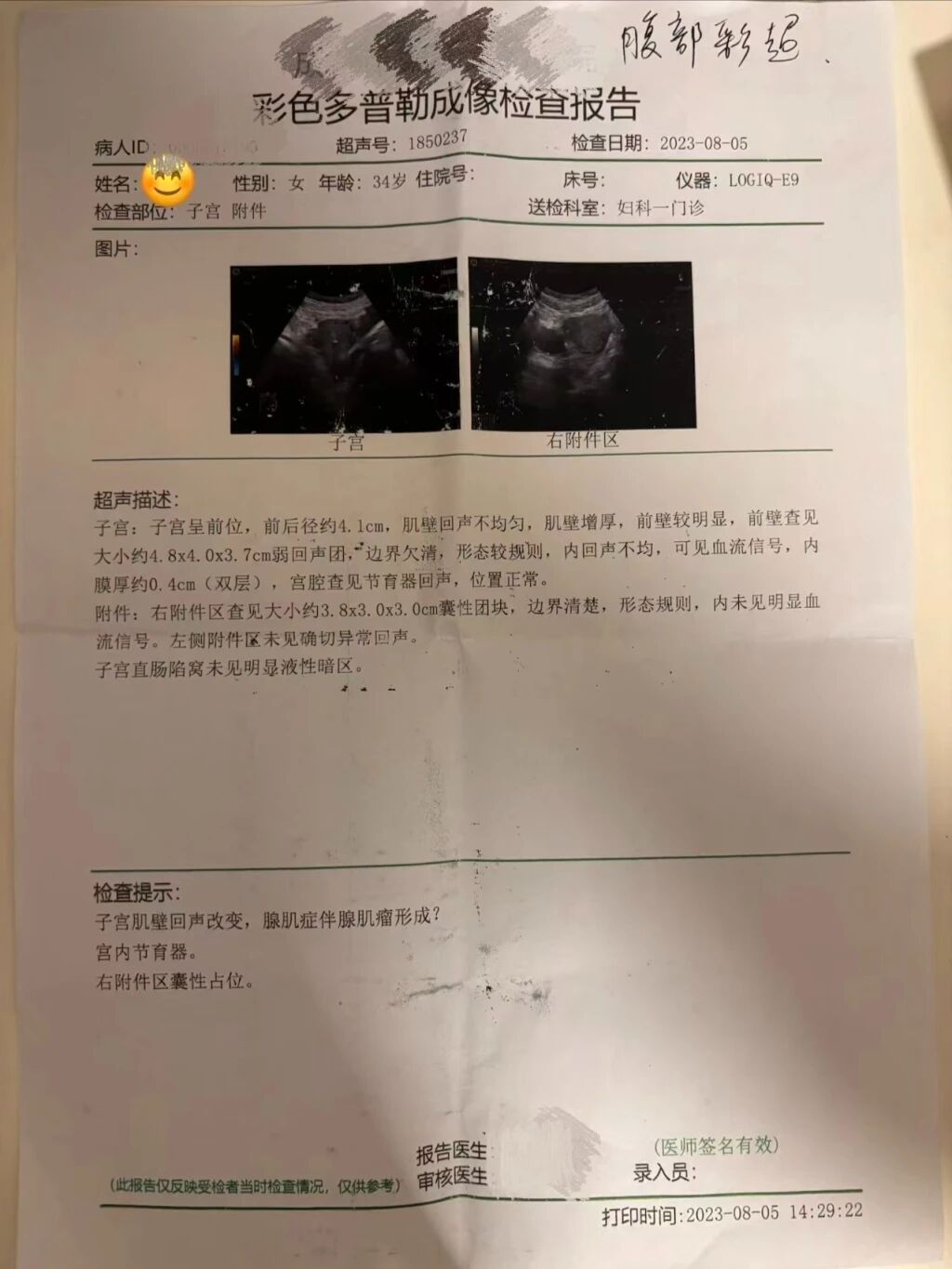 节育环2.jpg 节育环2.jpg